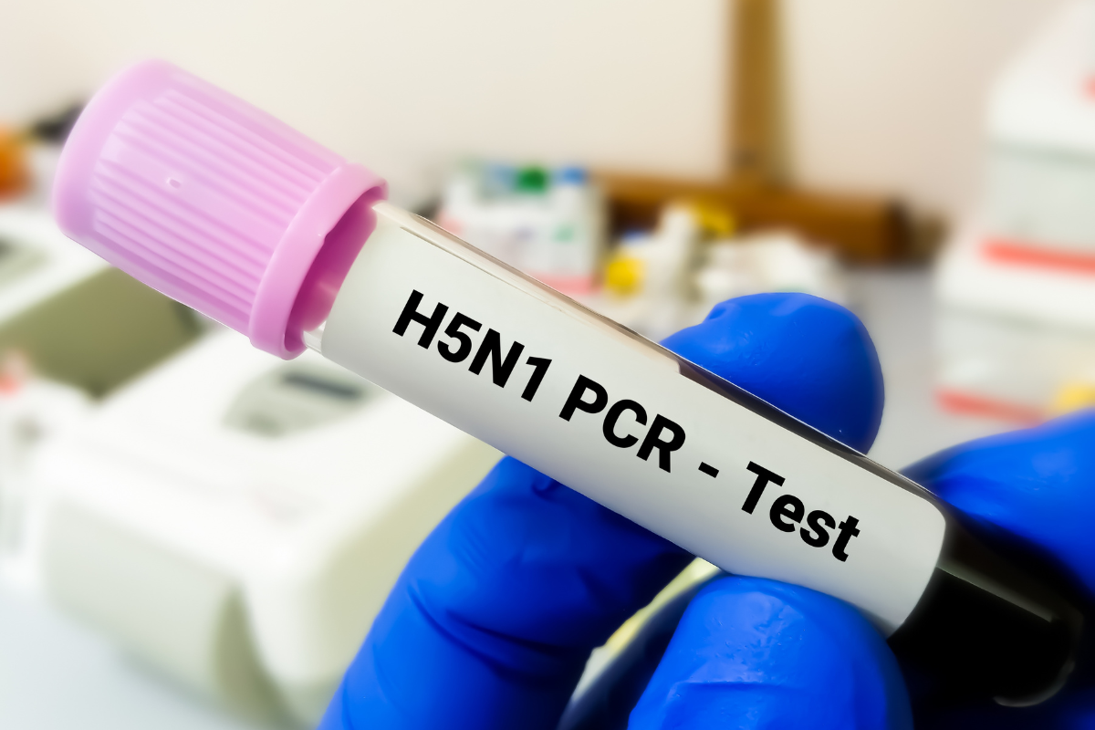 First U.S. death from bird flu reported in Louisiana