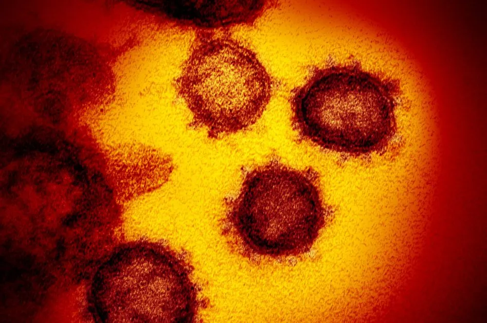 इंदौर के ज्वैलरी शोरुम में 31 लोग कोरोना संक्रमित