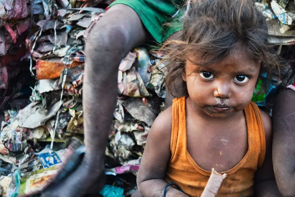 33 lakh children in India are malnourished