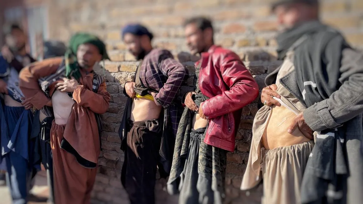 In Afghanistan, some sell their kidney for food