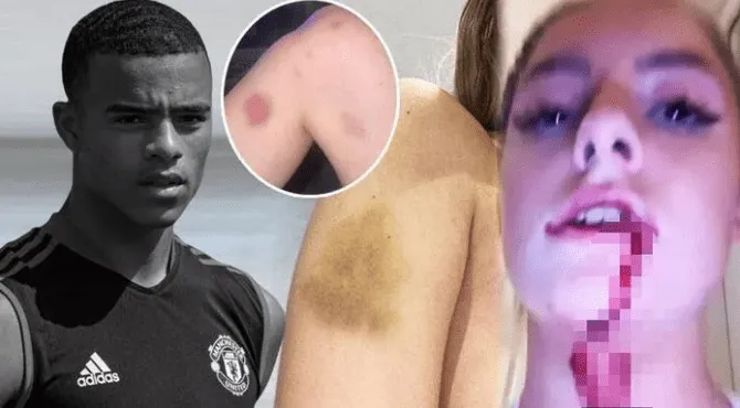 Mason Greenwood scandal; A Complete story