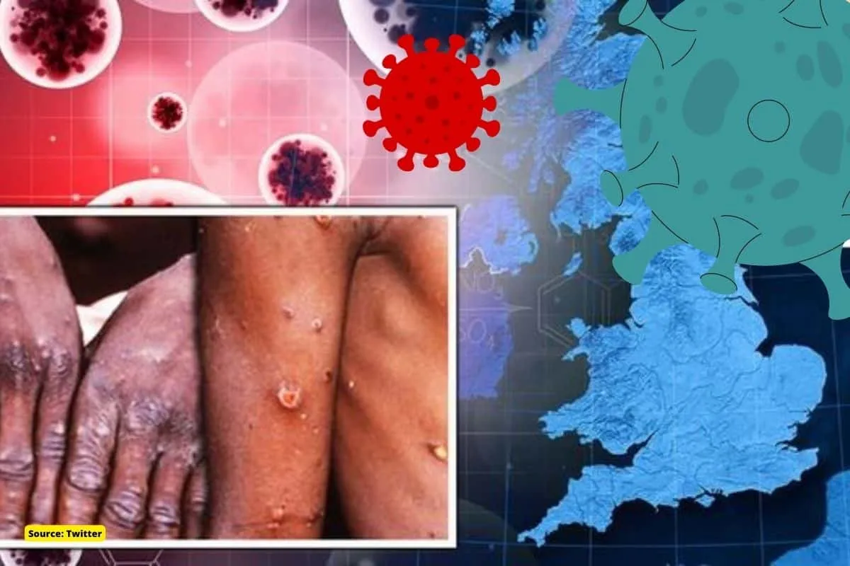 What is deadly Monkeypox virus confirmed in the UK, will it spread?
